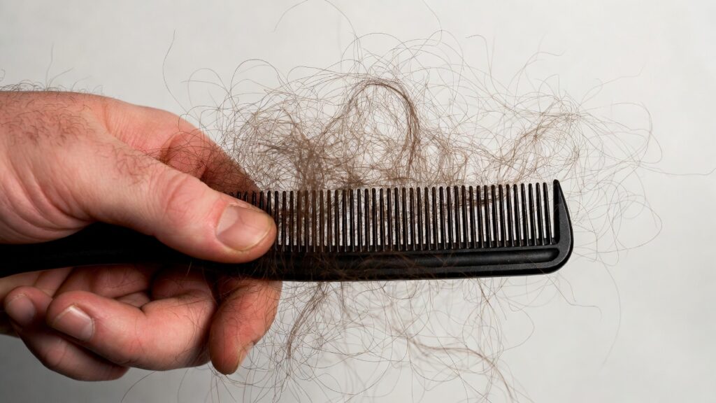 29b38a72 3272 46cf aa64 f1fba192bdb3 How to Stop Hair Fall and Regain Thicker, Healthier Hair